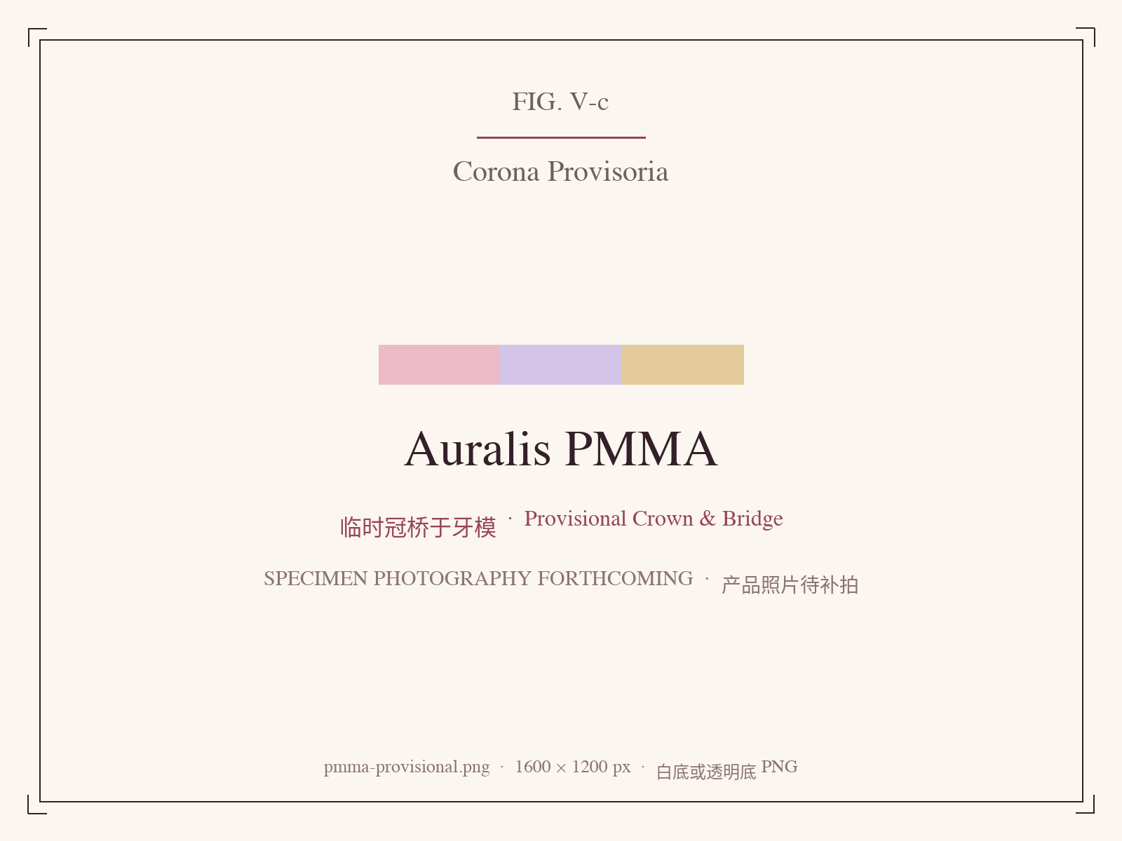 Milled PMMA provisional crown and bridge on model