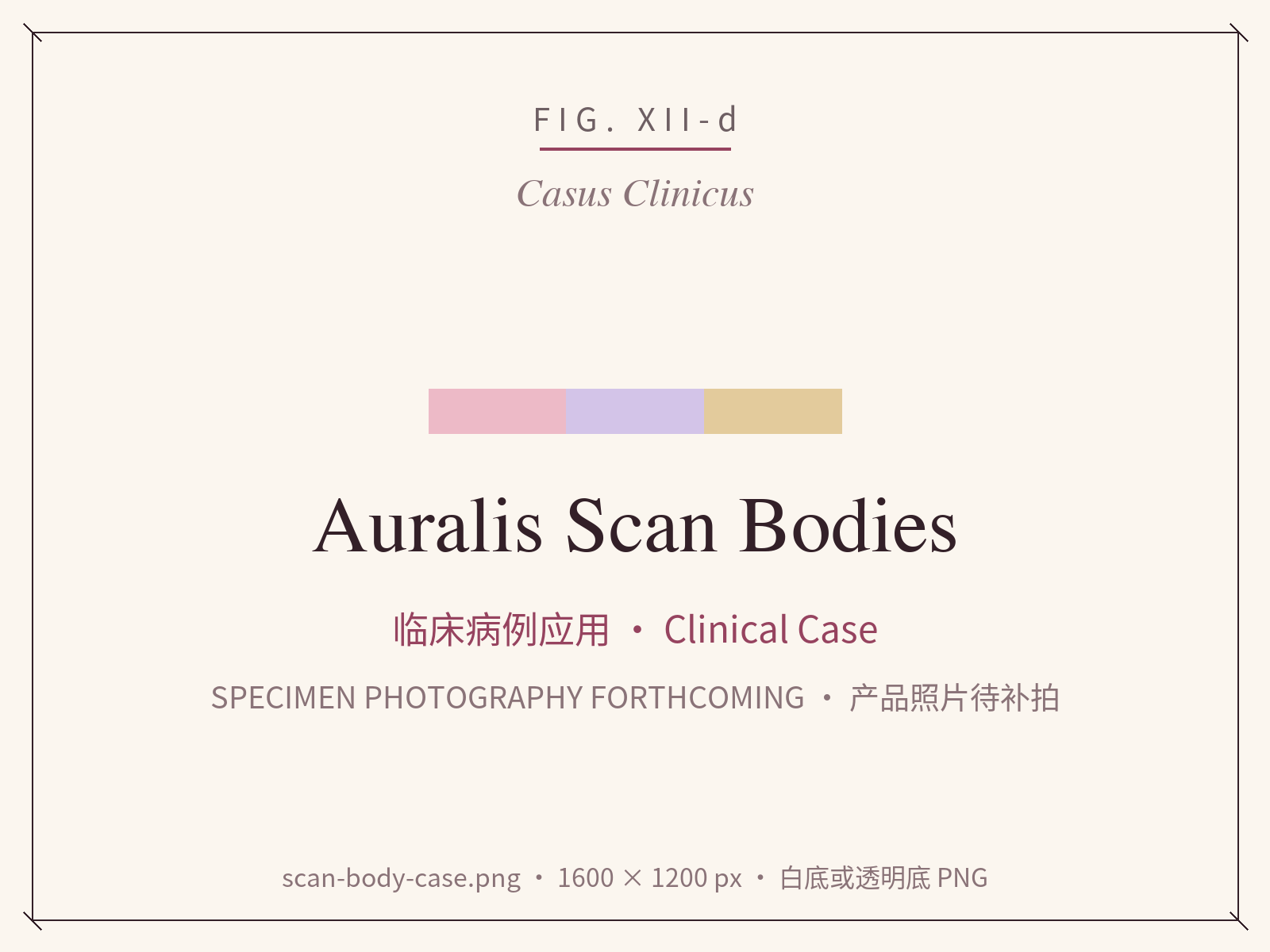 Scan body in a single-implant case